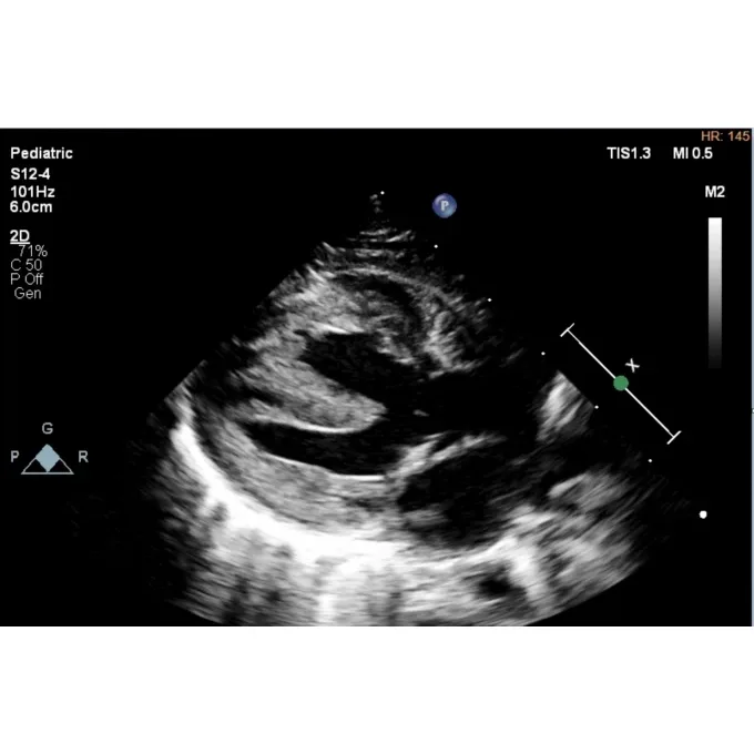Philips EPIQ CVx ультразвуковой аппарат Philips EPIQ CVx ультразвуковой аппарат