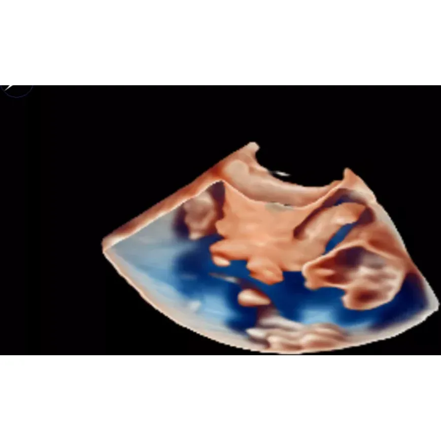Philips EPIQ CVx ультразвуковой аппарат Philips EPIQ CVx ультразвуковой аппарат