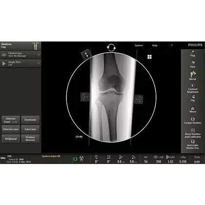 Philips Veradius Unity С-дуга Philips Veradius Unity С-дуга