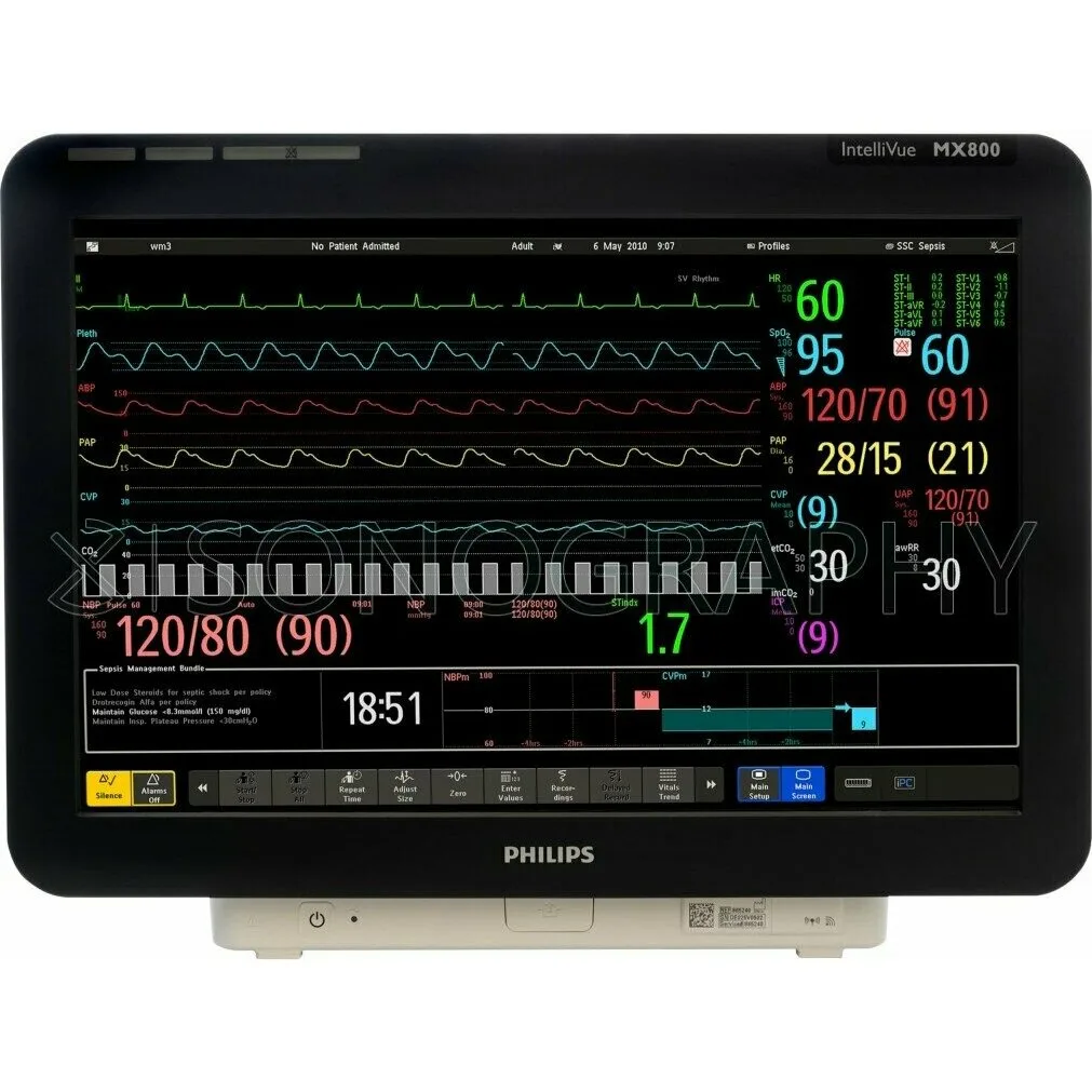 Philips IntelliVue MX800 прикроватный монитор пациента