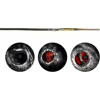 Philips Visions PV (0,018 дюйма) катетер ротационный Philips Visions PV (0,018 дюйма) катетер ротационный