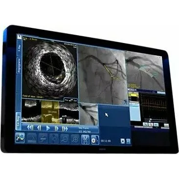 Philips SyncVision Cистема для выполнения высокоточной терапии Philips SyncVision Cистема для выполнения высокоточной терапии