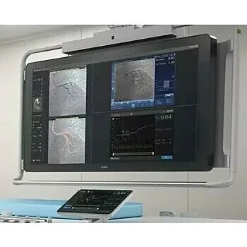 Philips SyncVision Cистема для выполнения высокоточной терапии Philips SyncVision Cистема для выполнения высокоточной терапии