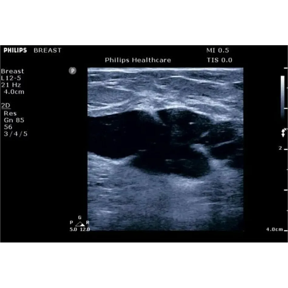 Philips ClearVue 650 ультразвуковой аппарат Philips ClearVue 650 ультразвуковой аппарат