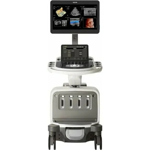 Philips EPIQ Elite ультразвуковой аппарат Philips EPIQ Elite ультразвуковой аппарат